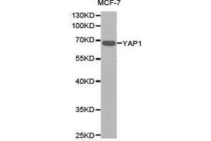 Western Blotting (WB) image for anti-Yes-Associated Protein 1 (YAP1) antibody (ABIN1875372) (YAP1 anticorps)