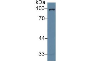 Western Blot; Sample: Human Hela cell lysate; Primary Ab: 2µg/ml Rabbit Anti-Human NR3C1 Antibody Second Ab: 0. (Glucocorticoid Receptor anticorps  (AA 532-730))