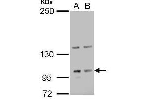 WB Image Laminin gamma 2 antibody detects Laminin gamma 2 protein by Western blot analysis. (LAMC2 anticorps)