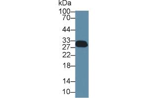 Detection of SFN in Rat Cerebrum lysate using Polyclonal Antibody to Stratifin (SFN) (14-3-3 sigma/SFN anticorps  (AA 1-248))