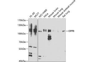 Western blot analysis of extracts of various cell lines, using DPP8 antibody (ABIN6130315, ABIN6139800, ABIN6139801 and ABIN6222925) at 1:1000 dilution. (DPP8 anticorps  (AA 10-230))