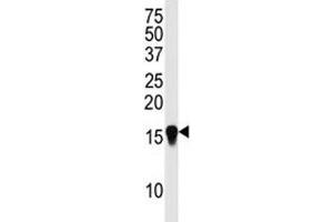 Western blot analysis of SUMO4 antibody (M55 Wild type) in HepG2 lysate.