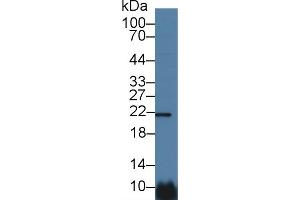 Detection of CSN1 in Human Hela cell lysate using Polyclonal Antibody to Casein Alpha (CSN1) (Casein alpha S1 anticorps  (AA 16-185))