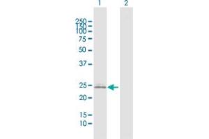 Western Blot analysis of IGKC expression in transfected 293T cell line by IGKC MaxPab polyclonal antibody. (IGKC anticorps  (AA 1-234))