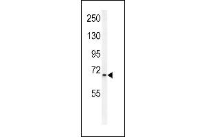 SLC25A12 Antibody (N-Term) (ABIN654231 and ABIN2844065) western blot analysis in mouse bladder tissue lysates (15 μg/lane).