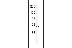 SLC25A12 Antikörper  (N-Term)