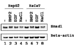 Image no. 1 for anti-SMAD, Mothers Against DPP Homolog 1 (SMAD1) (Ser206) antibody (ABIN401471)