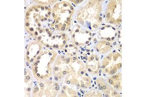 Immunohistochemistry of paraffin-embedded human kidney using ZNF264 antibody at dilution of 1:100 (x400 lens). (ZNF264 anticorps)