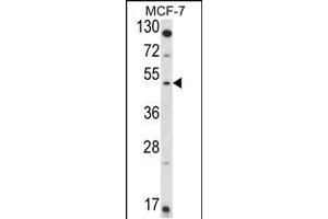 HSD11B2 Antikörper  (AA 277-306)