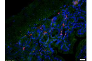 Formalin-fixed and paraffin embedded mouse intestine labeled with Anti-CX3CR1 Polyclonal Antibody, Unconjugated (ABIN733583) at 1:200 followed by conjugation to the secondary antibody Goat Anti-Rabbit IgG, Cy3 conjugated used at 1:200 dilution for 40 minutes at 37°C and DAPI staining