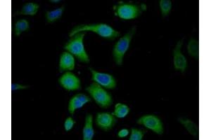 Detection of DKK3 in Human HepG2 cell using Polyclonal Antibody to Dickkopf Related Protein 3 (DKK3)