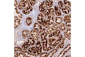 Immunohistochemical staining of human kidney with PSAPL1 polyclonal antibody  shows strong cytoplasmic positivity in cells in tubules with distinct extracellular material at 1:50-1:200 dilution. (PSAPL1 anticorps)