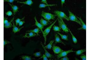 Figure 2 IF analysis of IRF3 using anti-IRF3 antibody (ABIN7599372).