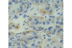 Figure. (ITGA5 anticorps  (AA 895-1049))