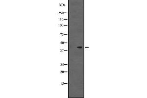 Western blot analysis of GPR86/GPR94 expression in Hela cell lysate,The lane on the left is treated with the antigen-specific peptide. (Purinergic Receptor P2Y, G-Protein Coupled, 13 (P2RY13) (C-Term) anticorps)