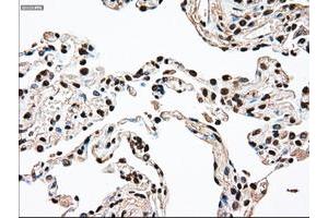 Image no. 4 for anti-Sjogren Syndrome Antigen B (SSB) antibody (ABIN1501146)