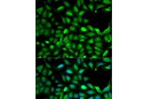 Immunofluorescence analysis of A-549 cells using IGF2 Polyclonal Antibody