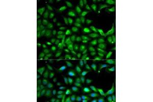 Immunofluorescence analysis of A-549 cells using IGF2 Polyclonal Antibody (IGF2 anticorps)