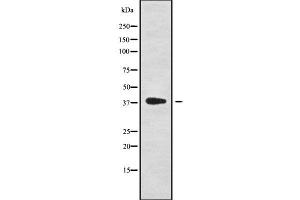 Western blot analysis NKX61 using HepG2 whole cell lysates (NKX6-1 anticorps  (Internal Region))