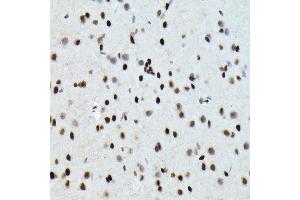 Immunohistochemistry of paraffin-embedded rat brain using FOSB Rabbit pAb (ABIN7267159) at dilution of 1:150 (40x lens).