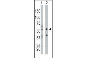 The anti-PRKR Pab (ABIN392778 and ABIN2837994) is used in Western blot to detect PRKR in mouse liver tissue lysate (Lane 1) and HepG2 cell lysate (Lane 2). (EIF2AK2 anticorps  (N-Term))