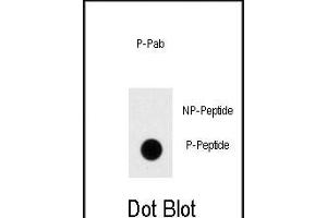 Dot blot analysis of anti-Phospho-Dnmt1-p Antibody (ABIN389917 and ABIN2839744) on nitrocellulose membrane.