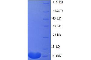 Connective Tissue Growth Factor (CTGF) (AA 253-349), (partial) protein (His tag)