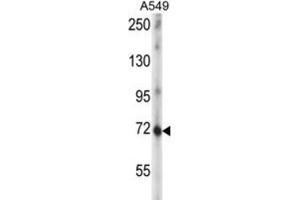 Western Blotting (WB) image for anti-Zinc Finger Protein 429 (ZNF429) antibody (ABIN5016641) (ZNF429 anticorps)