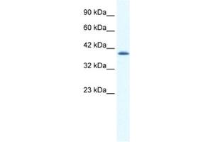 Western Blotting (WB) image for anti-Cation Channel, Sperm Associated 2 (CATSPER2) antibody (ABIN2461150) (CATSPER2 anticorps)
