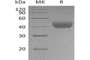 Western Blotting (WB) image for CD38 protein (His tag) (ABIN7321271) (CD38 Protein (His tag))