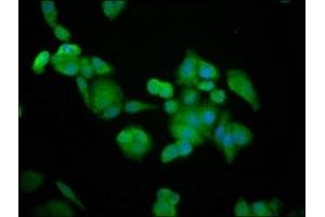 Immunofluorescence staining of PC-3 cells with ABIN7145758 at 1:100, counter-stained with DAPI. (BRAP anticorps  (AA 13-124))