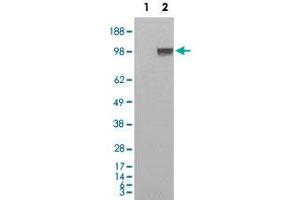 HEK293 overexpressing Human ENPP1 and probed with ENPP1 polyclonal antibody  (mock transfection in first lane) . (ENPP1 anticorps  (C-Term))