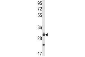 Western blot analysis of MyD88 antibody and mouse lung tissue lysate. (MYD88 anticorps  (AA 136-164))