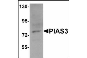 Western blot analysis of PIAS3 in K562 cell lysate with PIAS3 antibody at 1 µg/ml.