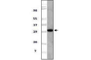 Western Blotting (WB) image for anti-Alveolar Soft Part Sarcoma Chromosome Region, Candidate 1 (ASPSCR1) (truncated) antibody (ABIN2464084) (ASPSCR1 anticorps  (truncated))