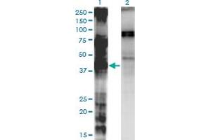Western Blot analysis of LASS3 expression in transfected 293T cell line by LASS3 monoclonal antibody (M02), clone 6C12. (LASS3 anticorps  (AA 57-134))