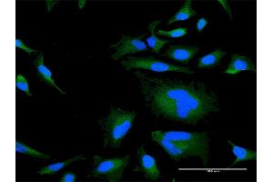 Immunofluorescence of purified MaxPab antibody to RGS21 on HeLa cell. (RGS21 anticorps  (AA 1-152))