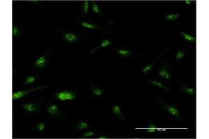 Immunofluorescence of monoclonal antibody to NUPL1 on HeLa cell. (NUPL1 anticorps  (AA 323-422))