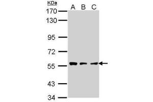 WB Image Sample (30 ug of whole cell lysate) A: A431 , B: H1299 C: Hela 7.