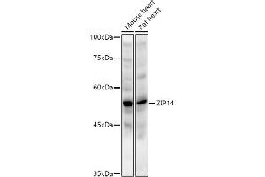 Western blot analysis of extracts of various cell lines, using ZIP14 antibody (ABIN6133191, ABIN6147993, ABIN6147994 and ABIN6214658) at 1:1000 dilution.