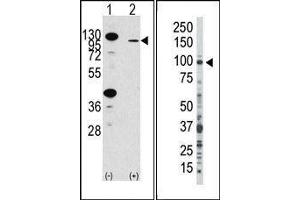 (LEFT) Western blot analysis of anti-hFGFR2-R22 Pab in 293 cell line lysates transiently transfected with the FGFR2 gene (2ug/lane). (FGFR2 anticorps  (N-Term))