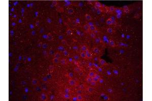 Formalin-fixed and paraffin embedded rat brain tissue labeled with Anti-PTPRA Polyclonal Antibody, unconjugated (ABIN754633) at 1:200 for 40 minutes at 37°C followed by labeling Rabbit Anti-Tubulin Beta, Cy3 conjugated 1:200, 40 minutes at 37°