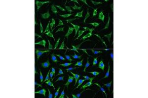 Immunofluorescence analysis of L929 cells using PAI-1/Serpin E1 antibody (ABIN6131330, ABIN6147601, ABIN6147603 and ABIN6221802) at dilution of 1:100. (PAI1 anticorps  (AA 24-402))
