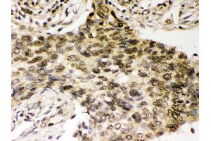 Immunohistochemistry (Paraffin-embedded Sections) (IHC (p)) image for anti-Checkpoint Kinase 2 (CHEK2) (AA 465-498), (C-Term) antibody (ABIN3043811) (CHEK2 anticorps  (C-Term))