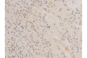 ABIN6267066 at 1/200 staining human TB tissue sections by IHC-P.