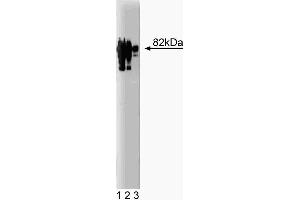 Western blot analysis of gamma-Catenin on a HeLa lysate. (JUP anticorps  (AA 553-738))