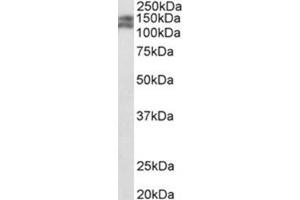 AP31771PU-N PARD3B antibody staining of Mouse fetal Kidney lysate at 0. (PARD3B anticorps  (C-Term))