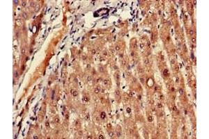 Immunohistochemistry of paraffin-embedded human liver tissue using ABIN7152606 at dilution of 1:100 (FADS1 anticorps  (AA 1-121))