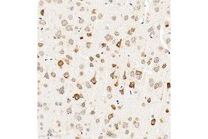 Immunohistochemistry of paraffin embedded mouse brain using CHST6 (ABIN7073302) at dilution of 1:2000 (300x lens)