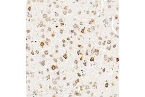 Immunohistochemistry of paraffin embedded mouse brain using CHST6 (ABIN7073302) at dilution of 1:2000 (300x lens) (CHST6 anticorps)